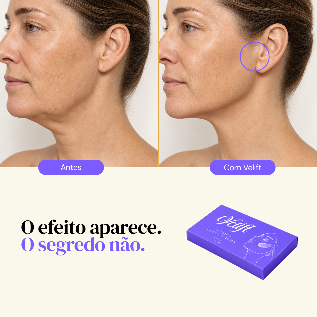 Pack Velift® - Face UP